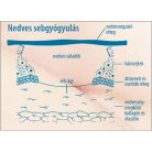 Lansinoh bimbóvédő krém HPA Lanolin 10ml 