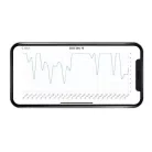 Milian légzésfigyelő PRO Bluetooth Standard 2db érzékelőlappal