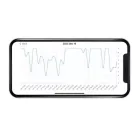 Milian légzésfigyelő PRO Bluetooth Twins 4db érzékelőlappal