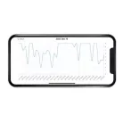 Milian légzésfigyelő PRO Bluetooth One 1db érzékelőlappal