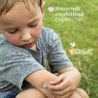 Csípés utáni tapaszok 30 db (3 év+) körömvirág, zanthoxylum, levendula és E-vitamin